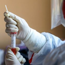 Saopštenje za javnost povodom širenja novog koronavirusa u Italiji i svijetu