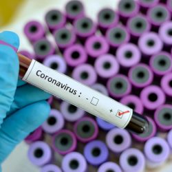 Najčešća pitanja o koronavirusu